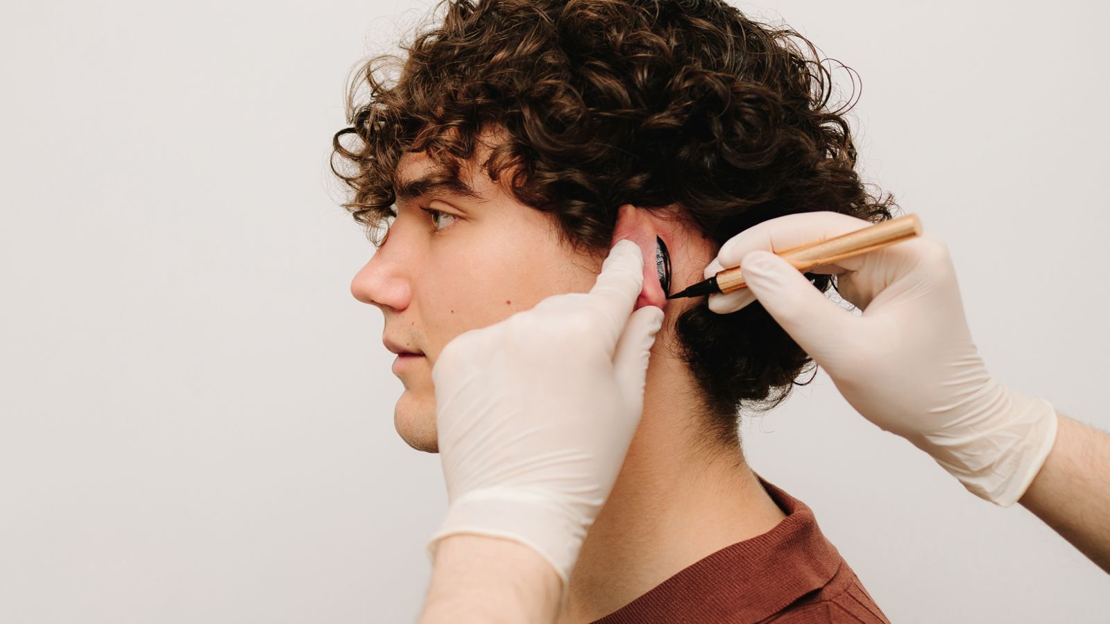 At what age can otoplasty be performed?