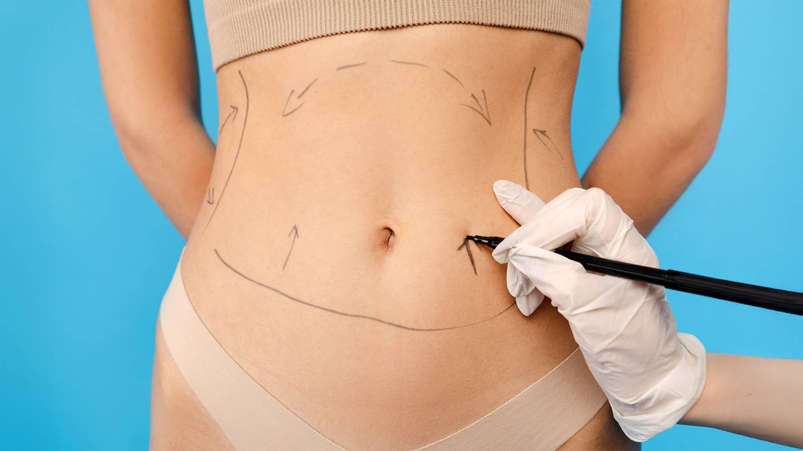 360 Liposuction